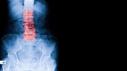 internal scan of body